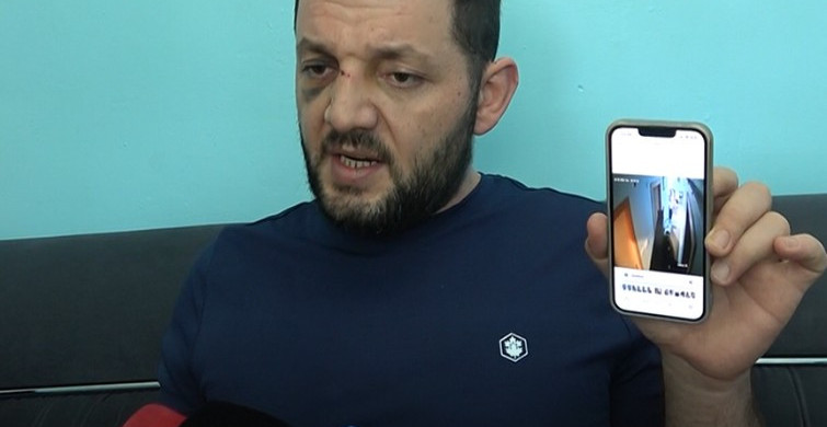 14 Aylık bebek ve babasına scooter'la  saldıran vicdansız için 36 yıl hapis !