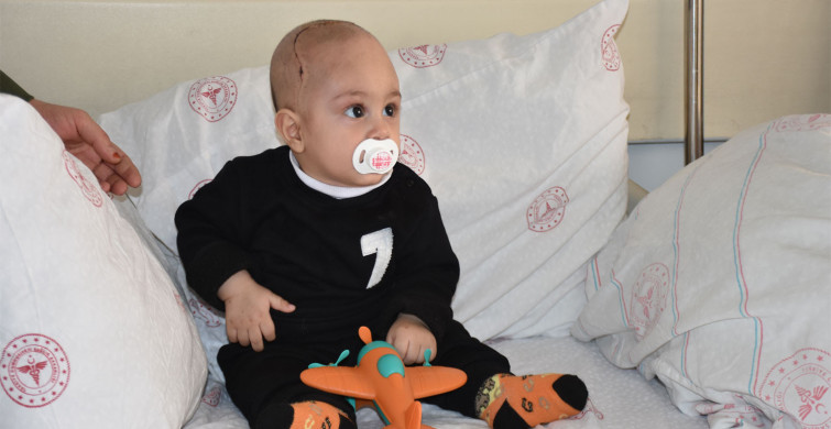 7 aylık bebeğin kafatasındaki şekil bozukluğu ameliyatla düzeltildi!