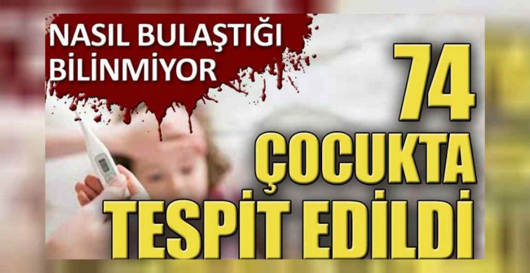 74 çocukta belirti gösteren gizemli hastalık nedir? Gizemli hastalık belirtileri nelerdir? Gizemli hastalık panik yaratmaya devam ediyor!