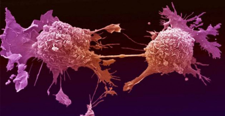 ABD'de Yeni Salgın Patlak Verdi, Salmonella Yayılıyor!