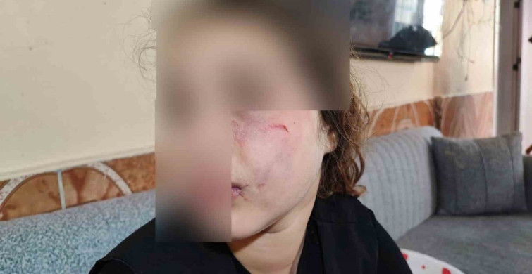 Adana'da Epilepsi Hastası Kız Sokakta Darp Edildi
