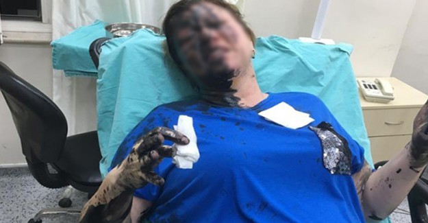 Adana'da İş Kadınını Darp Eden Zanlı Tutuklandı