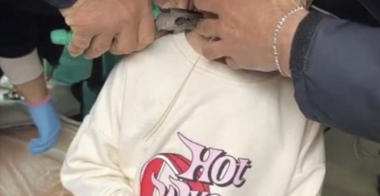 Adıyaman'da İtfaiye, Boynuna Kelepçe Sıkan Çocuğu Kurtardı