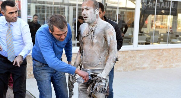 Antalya'da Kendini Yakan O Vatandaştan Acı Haber