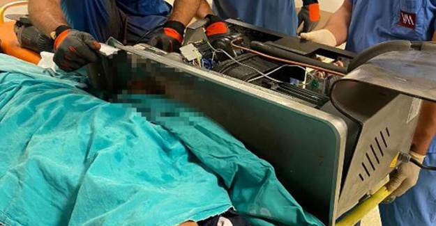 Asker Elini Kıyma Makinesine Kaptırdı, İtfaiye Kurtardı