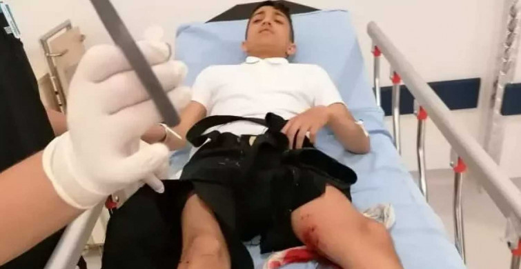 Başıboş köpek saldırısı devam ediyor: Okula giderken köpeklerin saldırısına uğradı