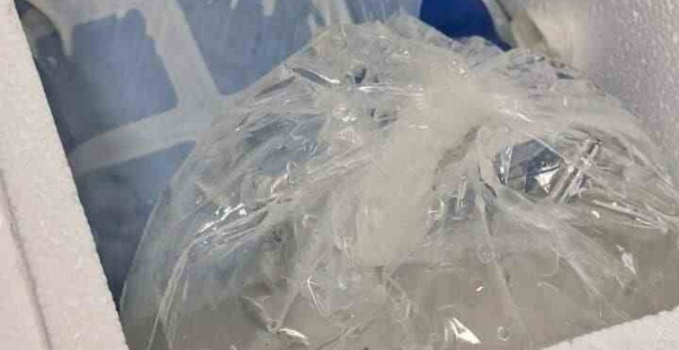 Başıboş Köpeklerin Saldırısı: Adamın Başparmağı Koptu