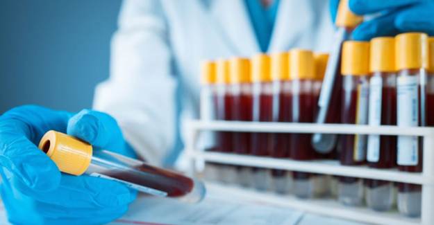 Basit Bir Test İle Cocid-19’un Kimler İçin Ölümcül Olduğu Anlaşılıyor 