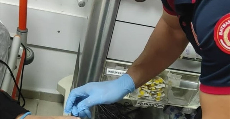 Batman'da Sıkışan Yüzük İtfaiye Ekipleri Tarafından Çıkarıldı