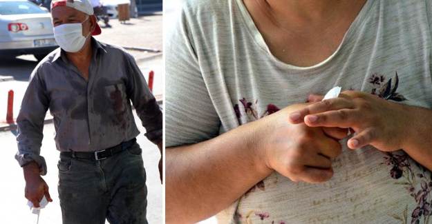 Kurban Bayramı'nın İlk Günü Yaralı Sayısı Rekor Kırdı!