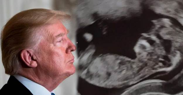 Bebeğinin Ultrason Görüntüsünün Trump'a Benzediğini Gören Anne Şok Oldu!