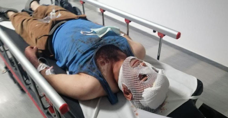 Bir Grup Maganda 15 Yaşındaki Kızı Kaçırmak İçin Evi Bastılar: 3 Yaralı