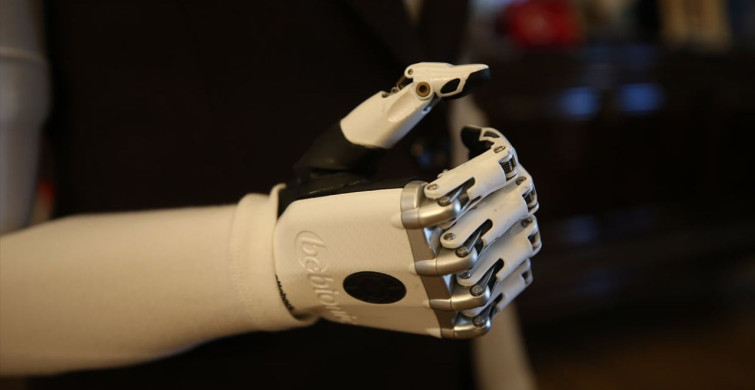 Biyonik Kollarla Hayata Tutunan Sevim Nur Türkmen'in Hikayesi