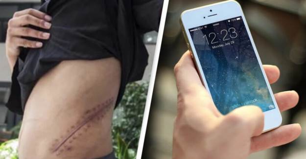 Böbreğini Satıp iPhone Alan Genç Hayatını Yatalak Geçirecek