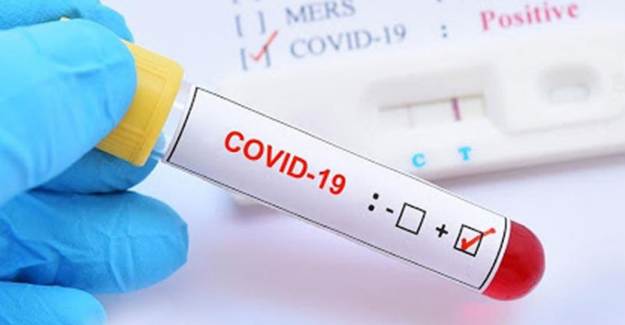 Coronavirüs'te Umut! İngiltere'den Yeni Tedavi Yöntemi