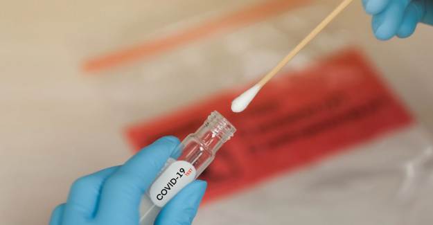Covid-19 Testinin Pozitif Sonuçları Yanıltıcı Olabiliyor