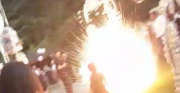 Dizine Havai Fişek Saplanan Kadın Sakat Kaldı
