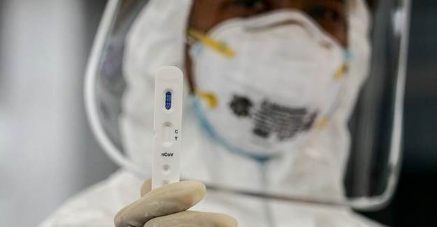 DSÖ 120 Milyon Kovid-19 Hızlı Test Kiti Sağlayacak