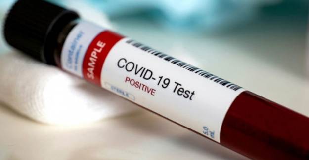 DSÖ Açıkladı! Küresel Nüfusun Yüzde 10'u Kovid-19 Olabilir