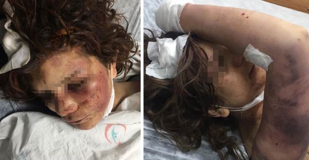 Eşini Zincirle Dövüp, Tırnaklarını Kerpetenle Çekti