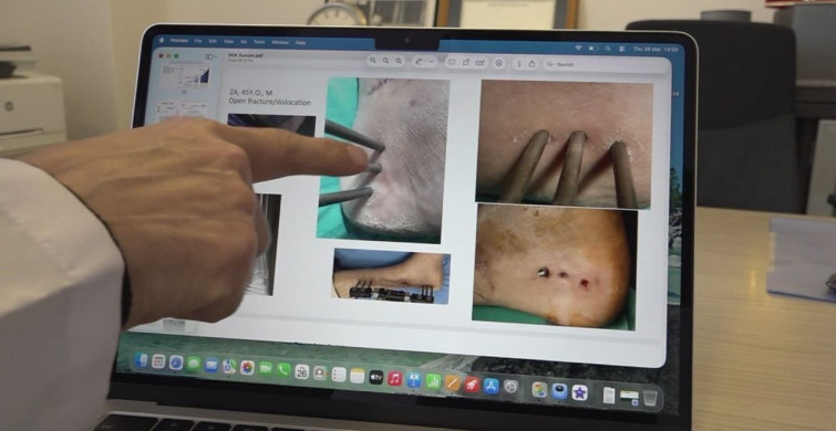 Eskişehir'de Dünyanın İlk Enfeksiyonlu Ortamlara Uygun Yapay Kemik Geliştirildi