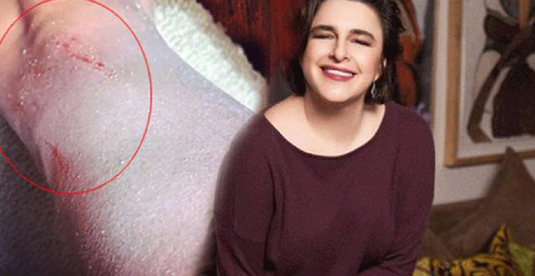 Esra Dermancıoğlu'nun Hastalığı Nedir?