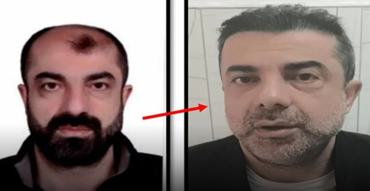 Estetikle Yüzünü Değiştirip Kaçan Firari Zanlı Yakalandı