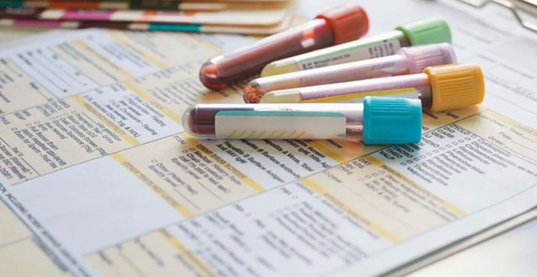 Ferritin nedir, ne demek? Ferritin testi nasıl yapılır? Ferritin normal değerleri