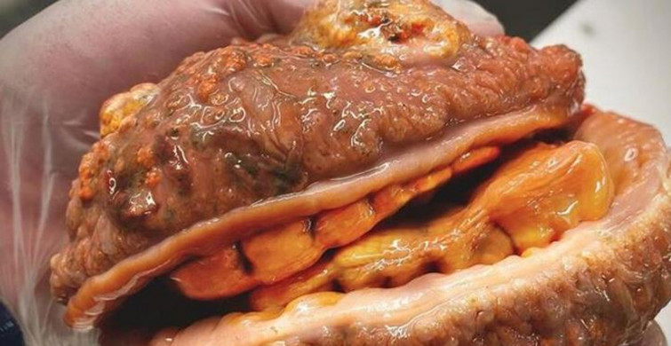 Hamburger Sandılar Balık Çıktı! Sosyal Medya Bu Görüntüleri Konuşuyor