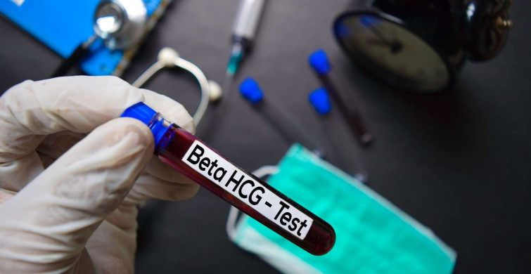 Hamilelik döneminde Beta HCG değerleri kaç olmalıdır? Beta HCG gebelik hesaplama tablosu 2022