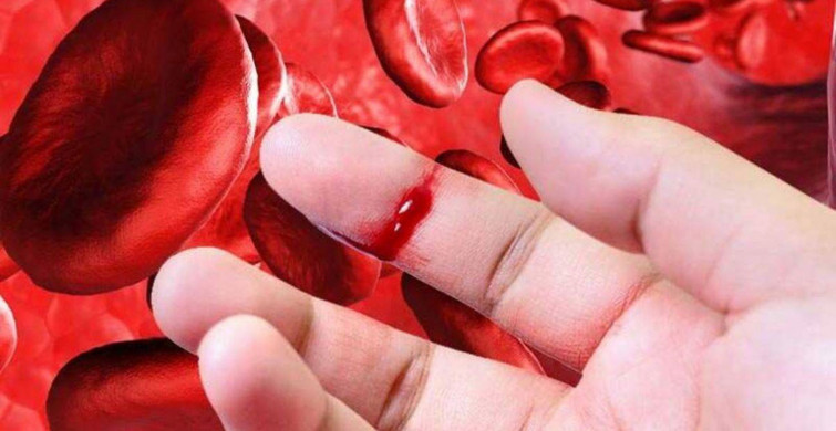 Hemofili hastalığı tedavi yönteminde dikkat edilmesi gereken yöntemler!