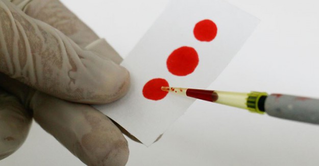 Hepatit B Taşıyan İnsanların %80'i Taşıdığını Bilmiyor