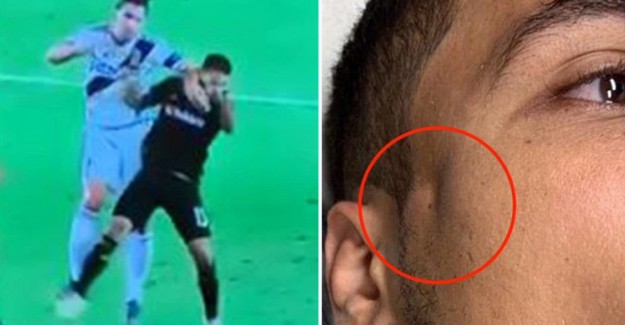 Ibrahimovic Rakibinin Elmacık Kemiğini Kırdı!