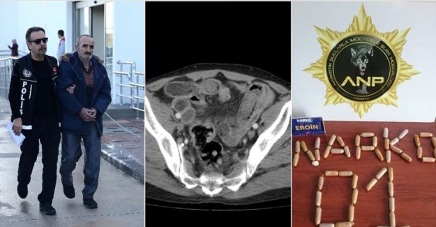İran'dan Adana'ya Midesinde 775 Gram Eroinle Gelen Şüpheli Yakalandı!
