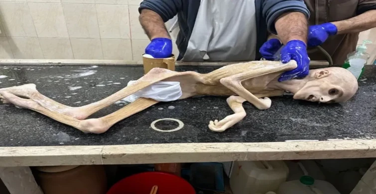 İsrail’in insanlık dramı pes dedirtti! Filistinli Yezen’den geriye bir deri bir kemik fotoğrafları kaldı…