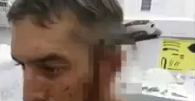 Kafasına 15 Santim Bıçak Saplandı, Sorduğu Soru Şaşırdı