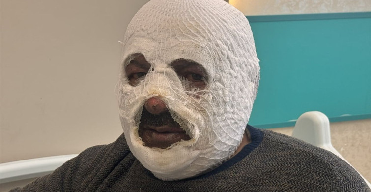 Kalorifer Kazanında Benzinle Yaşanan Kaza: 54 Yaşındaki Adam Yangın Kurbanı Oldu