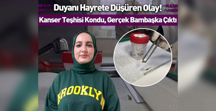 Kanser teşhisi kondu, badem zarı çıktı! Duyanı hayrete düşüren olay