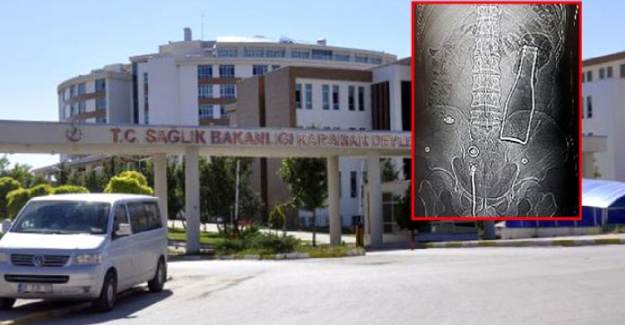 Karın Ağrısı İle Hastaneye Gitti, Vücudundan Soda Şişesi Çıktı
