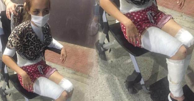 Karısını Önce Darp Etti, Sonra Isıtılmış Bıçakla İşkence Yaptı