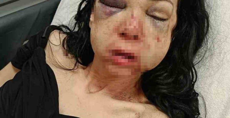 Kocaeli'de Darp Edilen Anne ve Oğulun Hikayesi