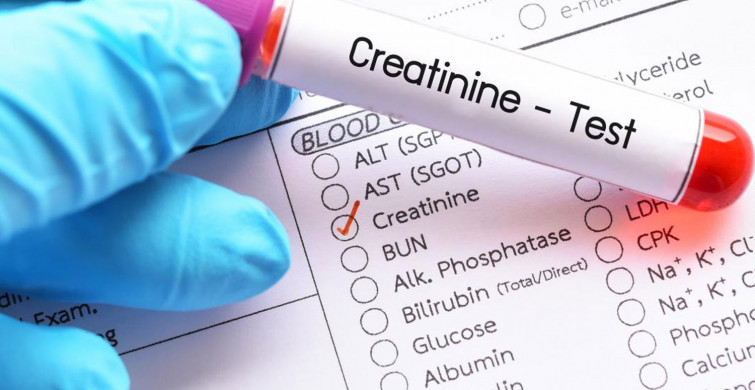 Kreatinin Nedir?