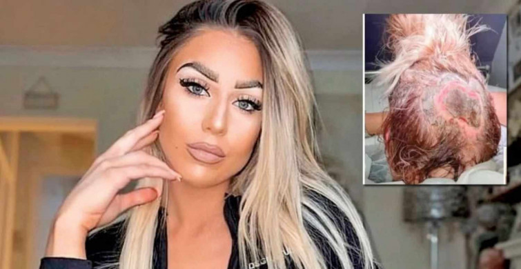 Kuaförde saçını boyattı, derisini kaybetti!