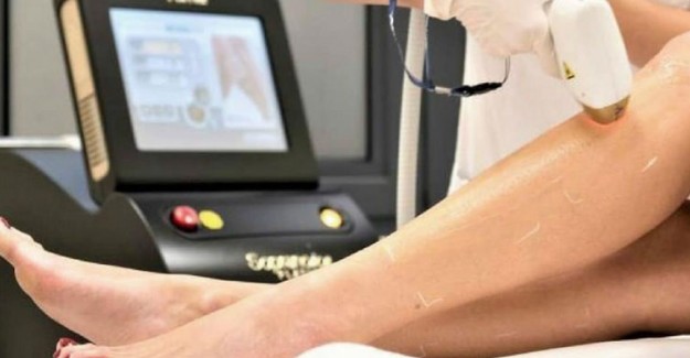 Lazer Epilasyon Nedir? Lazer Epilasyon Çeşitleri Nelerdir?