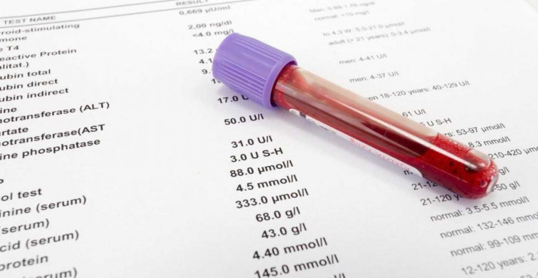 Lipaz enzimi normal değeri kaç olmalı? Lipaz değeri yüksekliği ve düşüklüğü tedavileri