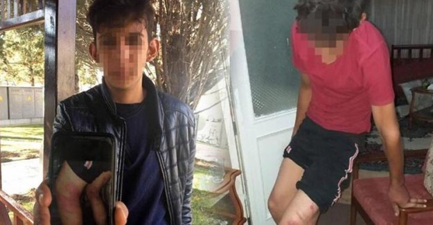 Lise Öğrencisi Ustasından Triger Kayışıyla Dayak Yedi