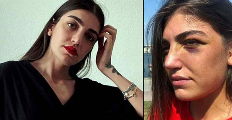 Manken Gizem Akbaş'ı Öldüresiye Dövdü! Dokuz Gün Tutuklu Kaldı