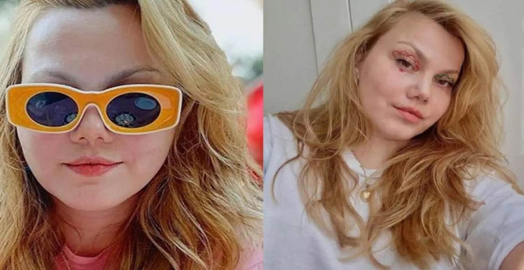 Merve Veziroğlu kimdir, nereli ve kaç yaşında? Youtuber Merve Veziroğlu neden gündemde, sağlık durumu nasıl?