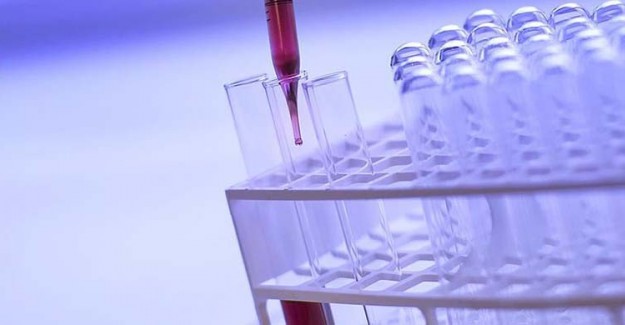 Nadir Hastalıklar Dünyada 300 Milyondan Fazla Kişiyi Etkiliyor