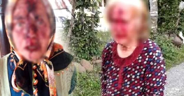 Ordu'da 70 Yaşındaki Adam Tartıştığı Yengesini Balta İle Başından Yaraladı